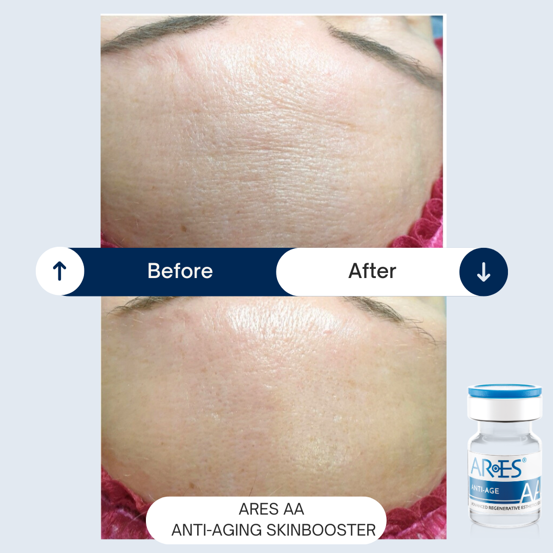Masterclass Anti-aging - Maandag 14 december - door Huidtherapeute Sophia Claes - Afbeelding 3