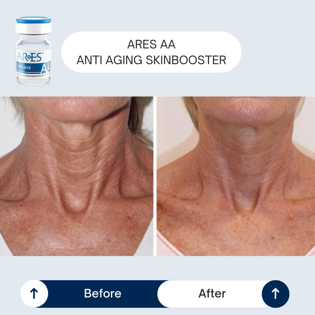 Masterclass Anti-aging - Maandag 14 december - door Huidtherapeute Sophia Claes - Afbeelding 4