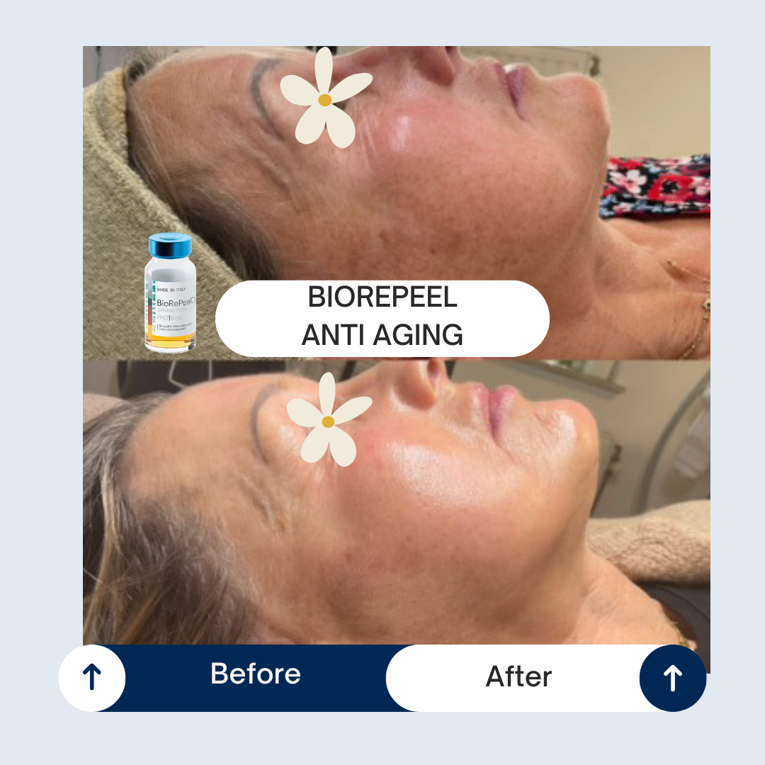 Masterclass Anti-aging - Maandag 14 december - door Huidtherapeute Sophia Claes - Afbeelding 5