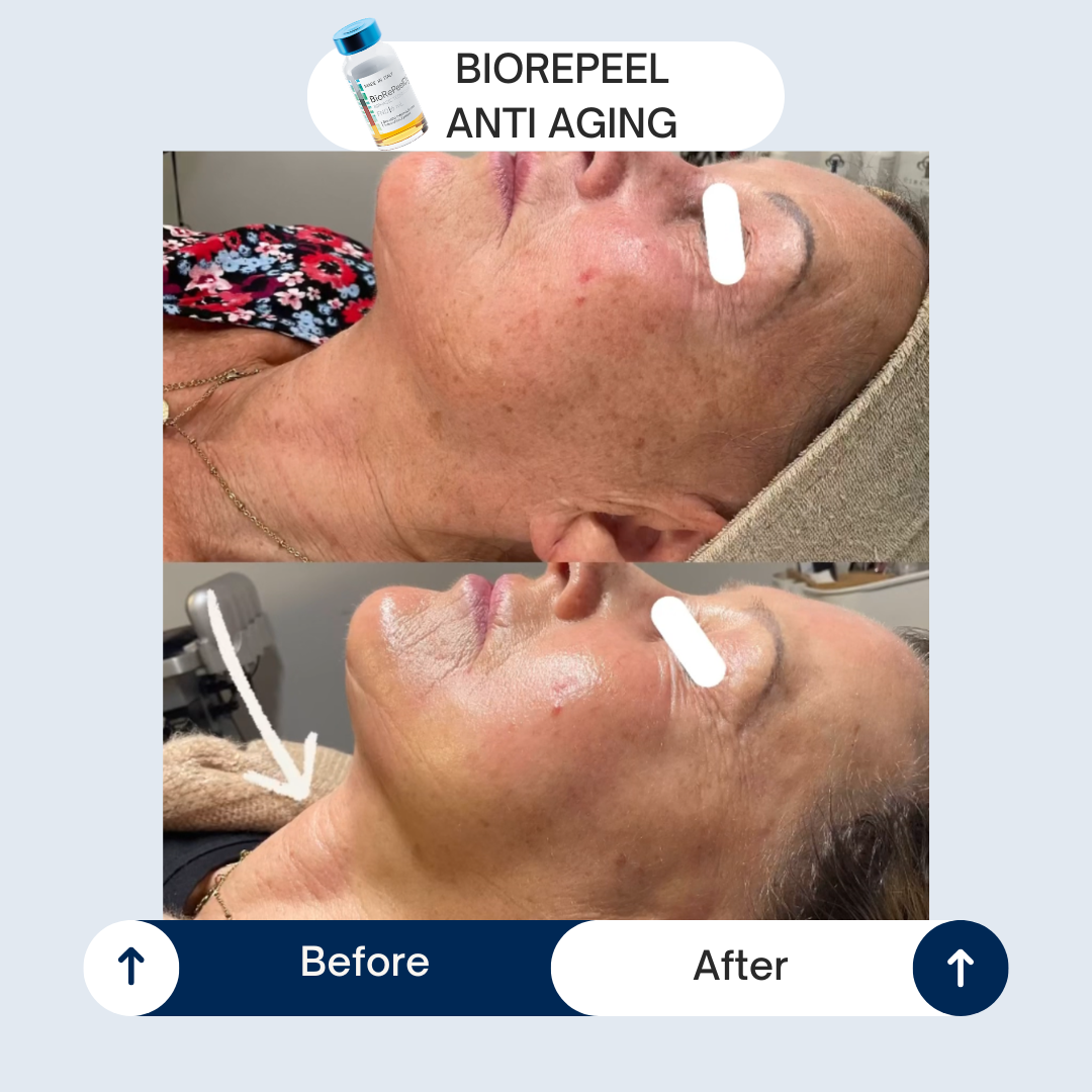 Masterclass Anti-aging - Maandag 14 december - door Huidtherapeute Sophia Claes - Afbeelding 2